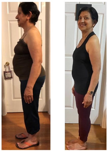 Amita-before-after Amita-before-after