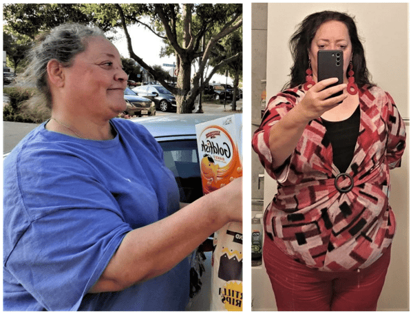 Kelly-L-before-after- Kelly-L-before-after-