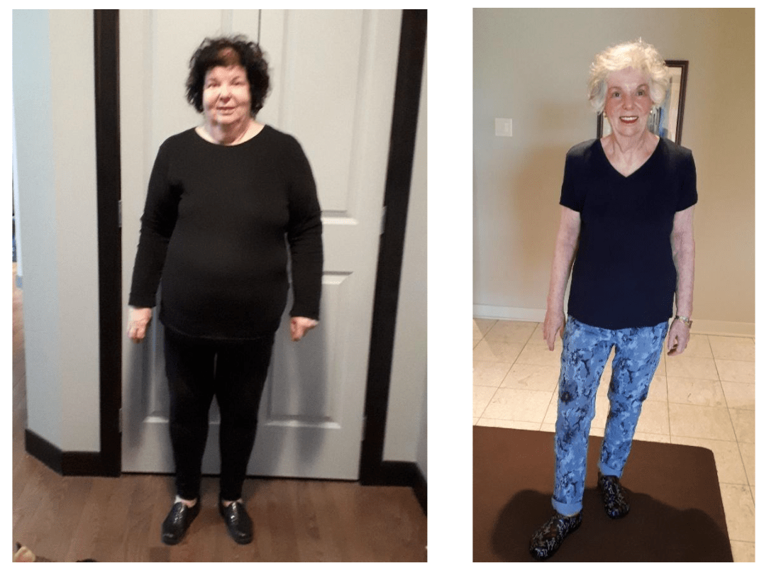 Annabelle-Bondar-before-after Annabelle-Bondar-before-after